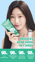 SENKA Perfect Whip Acne Care Facial Foam 50gr