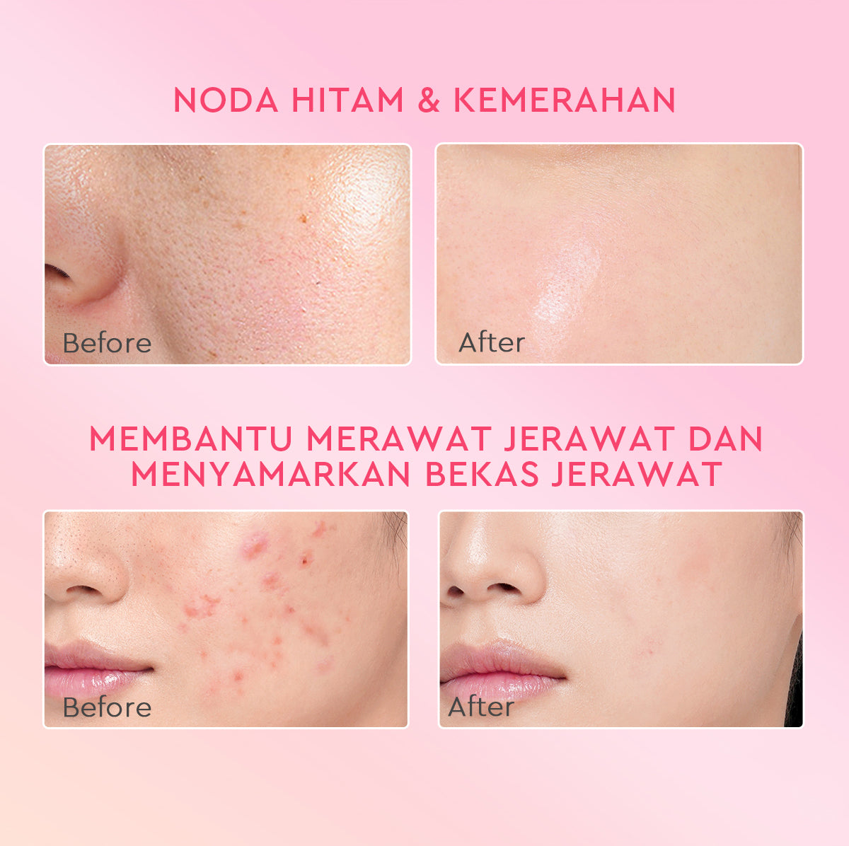 [ORDER NOW, HEMAT 30K]Glad2Glow Day & Night Renew Cerah Bundle Moisturizer+Serum Set Brightening 10%Niacinamide Peeling Eksfoliasi Retinol  tone up Pelembab Tubuh Kit Perawatan Kulit Hidrasi Delima Pelembab Wajah Pencerah Krim Gel g2glow official store