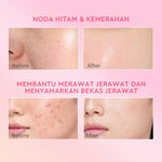 [ORDER NOW, HEMAT 30K]Glad2Glow Day & Night Renew Cerah Bundle Moisturizer+Serum Set Brightening 10%Niacinamide Peeling Eksfoliasi Retinol  tone up Pelembab Tubuh Kit Perawatan Kulit Hidrasi Delima Pelembab Wajah Pencerah Krim Gel g2glow official store