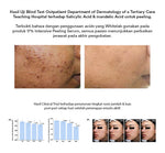 Whitelab 17% Intensive Peeling AHA BHA PHA Serum - Serum Eksfoliasi Pengangkat Sel Kulit Mati Memperbaiki Tekstur Kulit Sebum Melting Komedo [BPOM]