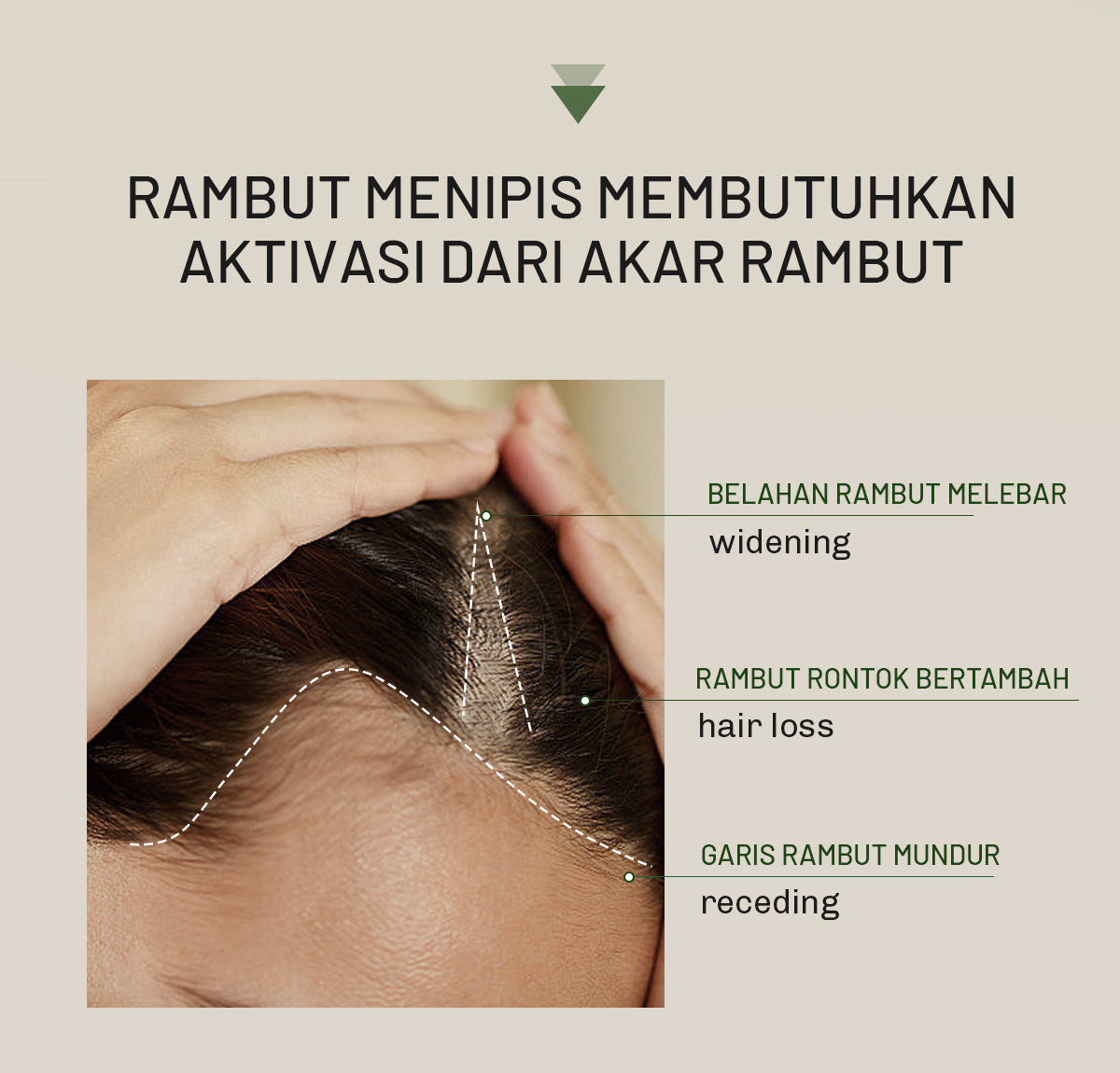 Lavojoy Hold Me Tight Pro Shampoo Spring Wonder | Hair Shampoo | Sampo Rambut | Shampoo Perawatan Rambut Rontok | Mempercepat Pertumbuhan Rambut | Mengurangi Kerontokkan | Sampo Ginseng & Jahe