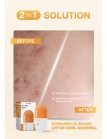 NEWLAB Acnalogy Boost || Acne Supplement || Minuman untuk Pereda Jerawat dan Bekasnya || Obat Jerawat dan Bruntusan 50gr