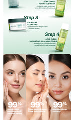 MICELLAR ALL VARIANT - NPURE Acne Power Clear Micellar Water 300ML / Micellar No Alcohol / SLS Free