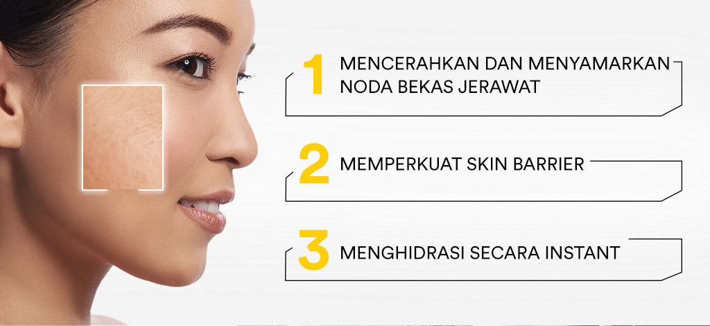 Whitelab Water Moisturizer Brightening - Pelembap Hidrasi Pencerah Wajah N-Dose+ 2.0 Intensive nite cream