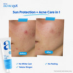 ERHA Acneact Acne Protection & Oil Control Sunscreen SPF 45+++ 30 g Sunscreen Jerawat Niacinamide