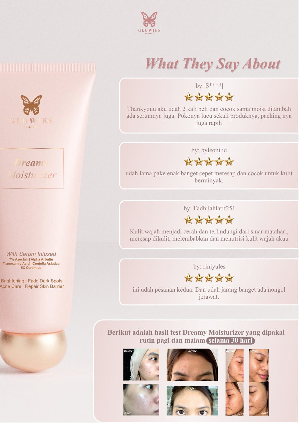 Ready Stock Glowies Beauty Dreamy Moisturizer 80ml Aman untuk Remaja & Kulit Sensitif with 7% Azelclair Niacinimide Alpha Arbutin 5x Ceramide Bantu Redakan Jerawat & PIE Memperbaiki Skin Barrier dan Acne Repair Non Comedogenic