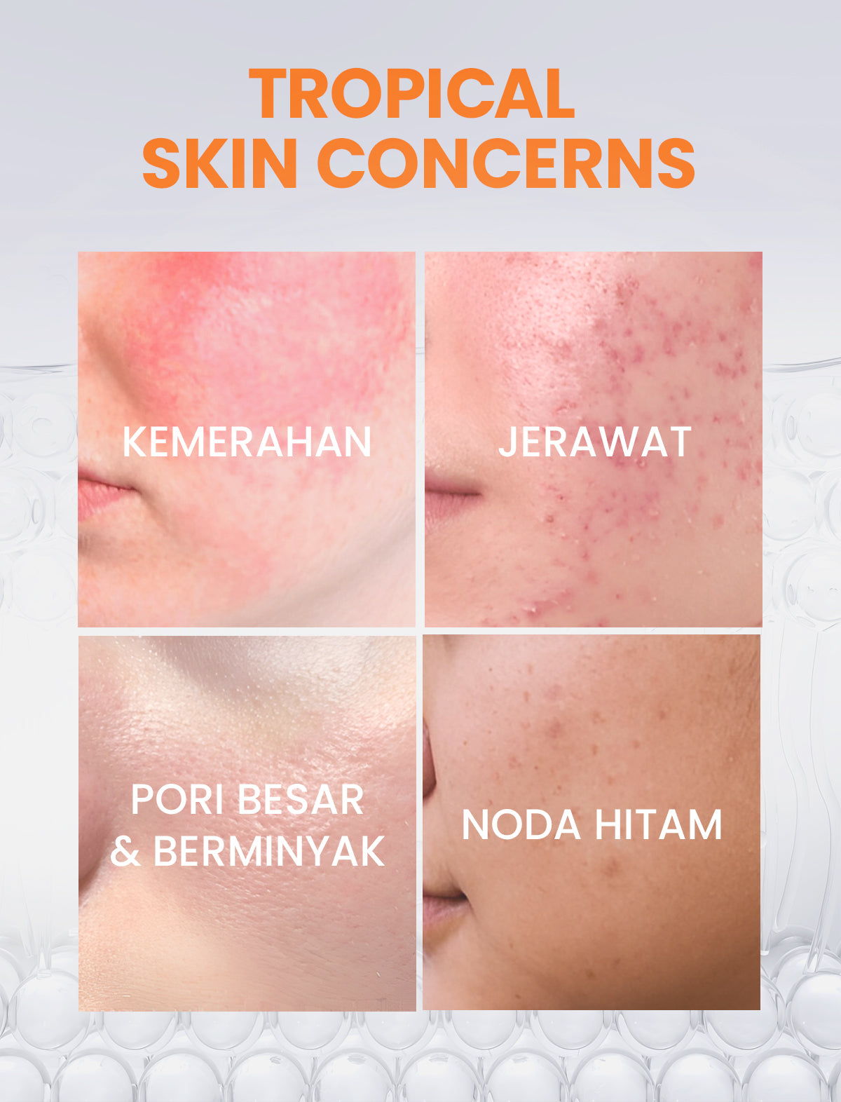 [NEW] YOU Radiance Plus Acne Brightening Serum | Tranexamic Acid | Niacinamide | Serum jerawat PIE PIH Kulit Berminyak dan Pori Besar