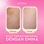 Emina Skin Diner Package 3pcs - Paket Skincare Moisturizer Serum Face Wash Sunscreen Pigmentation Brown Spots Pore Size Acne Collagen Boost