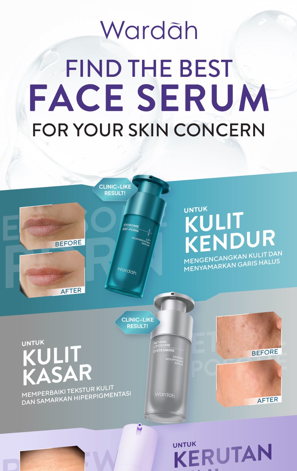WARDAH Serum Complete Series For Every Skin Concern - Exosome PDRN Serum Tosca, Retinal Serum Silver, Acnederm, C-Defense, Lightening, Crystal Secret, Renew You, Hydra Rose, Symradiance 399, Perfectyl Perfect Bright, Peeling Exfoliating Serum - Skincare