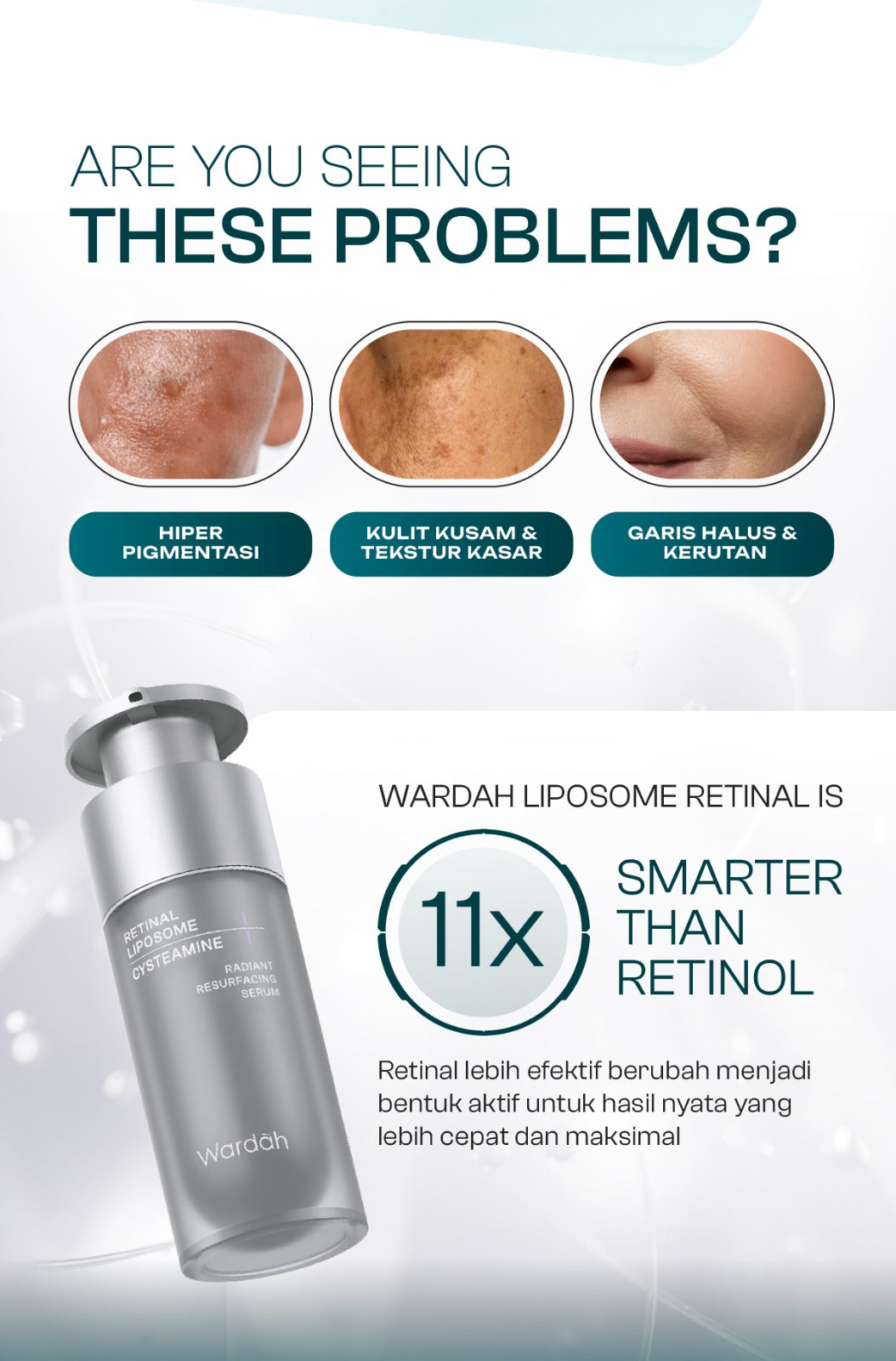 [SASHFIR PICKS!] Wardah Radiant Resurfacing Retinal Cysteamine Serum 30 ml - Serum Pencerah, Penghilang Kerutan, Retinol, Laser Effect, Renewal, Peeling - Skincare