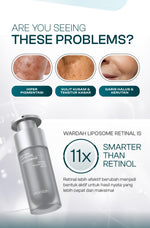 [SASHFIR PICKS!] Wardah Radiant Resurfacing Retinal Cysteamine Serum 30 ml - Serum Pencerah, Penghilang Kerutan, Retinol, Laser Effect, Renewal, Peeling - Skincare
