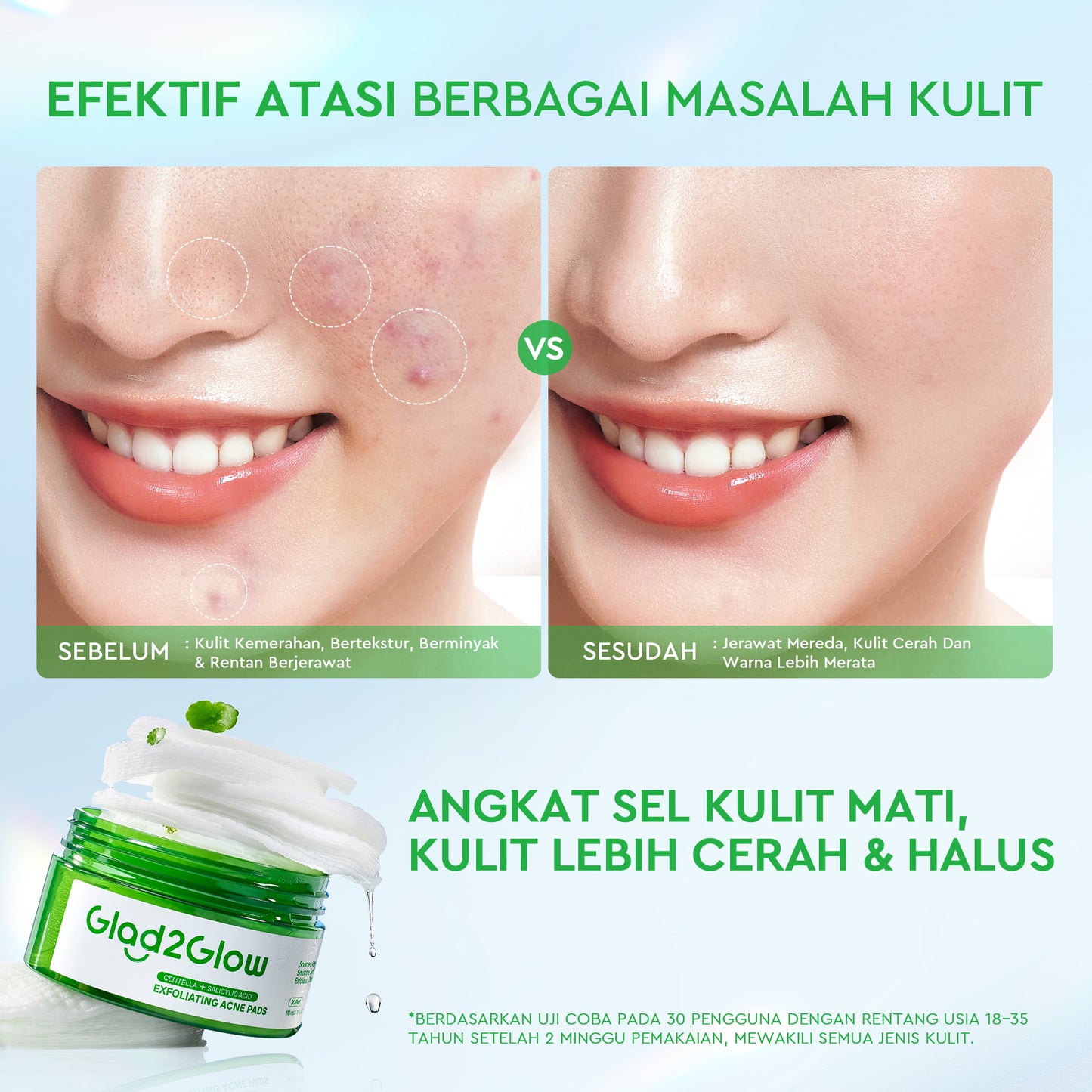 Glad2Glow Centella Salicylic Acid Exfoliating Acne Toner Pads Gentle Eksfoliasi Kulit Jerawat Kulit Sensitif (30 pads) Centella Pads Lactic Acid Malic AHA BHA Peeling Serum Acne Spot Serum Cica Acne Clear Pad Treatment Jerawat exfoliasi wajah obat jerawat
