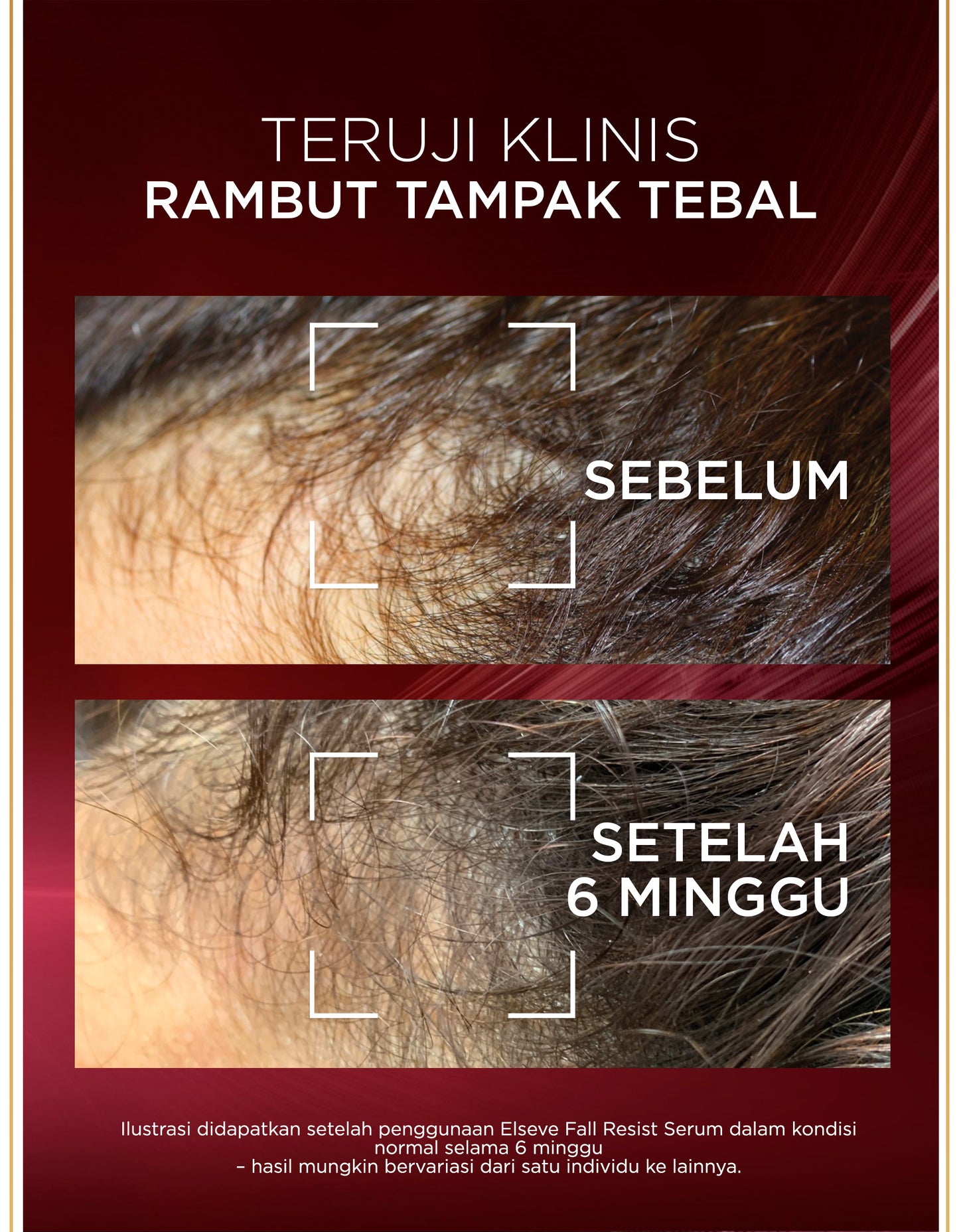 [BARU] L'Oreal Paris Elseve Aminexil Serum  - Anti Hair-Fall Serum With Aminexil - 102ml -  Perawatan Kekuatan Rambut, yang Rambutnya patah , Rambut Rontok, Serum Kulit Kepala.
