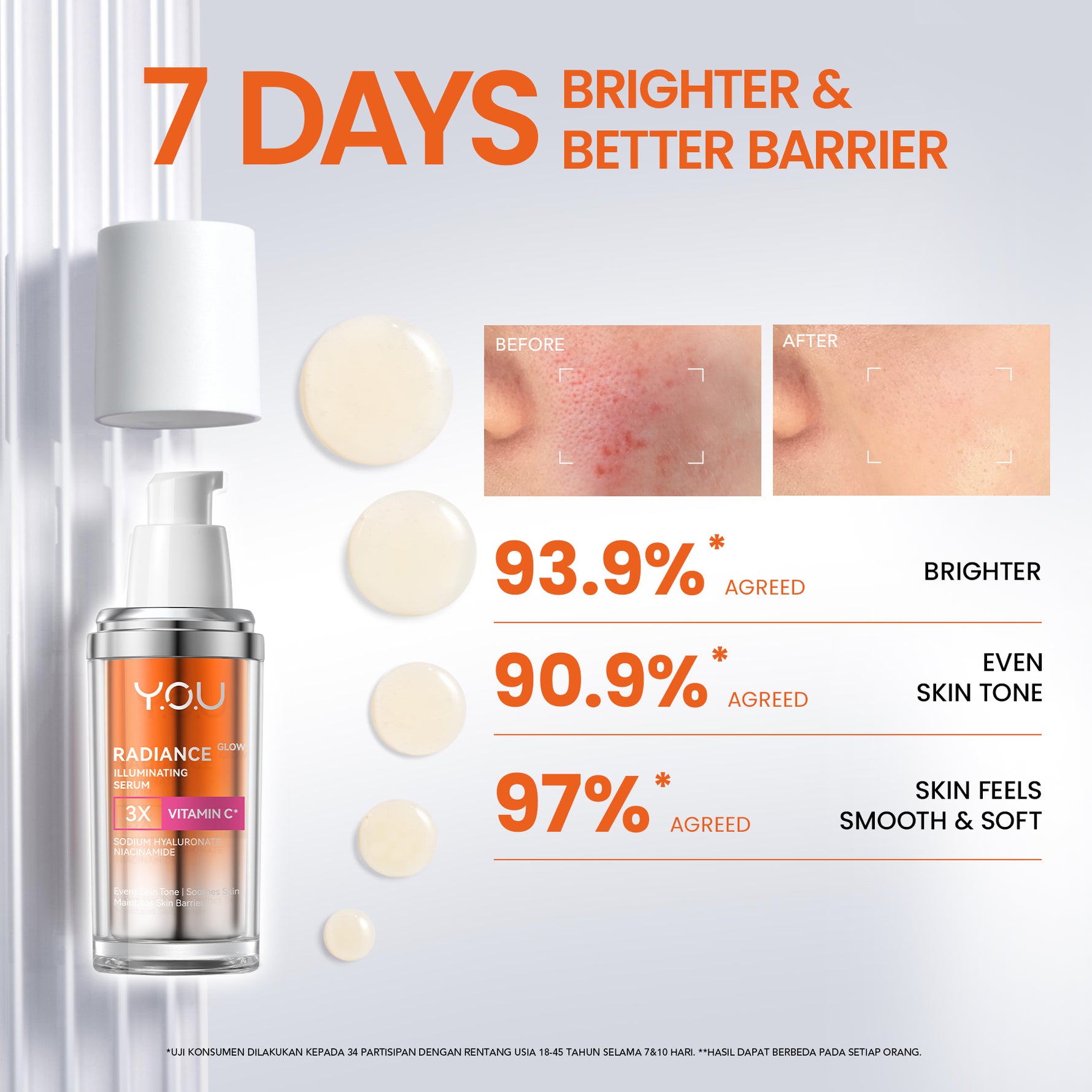 [NEW RADIANCE SERIES] YOU Radiance Plus Acne Brightening Serum | YOU Radiance Glow Illuminating Serum | YOU Radiance UP! Spotless Brightening Serum