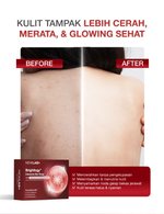 [PAKET HEMAT] NEWLAB Brightlogy Intensive Ultimate Soap Bar - Sabun Badan Memutihkan &  Mencerahhkan, Meratakan warna kulit dan lembap
