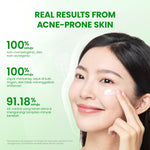 [NEW] YOU Sunbrella Acne Shield Light Sunscreen SPF40+ PA++++ | Tabir Surya Oil Control untuk Kulit Berjerawat | Sensitive Acne Skin Friendly | UVA UVB Blue Light