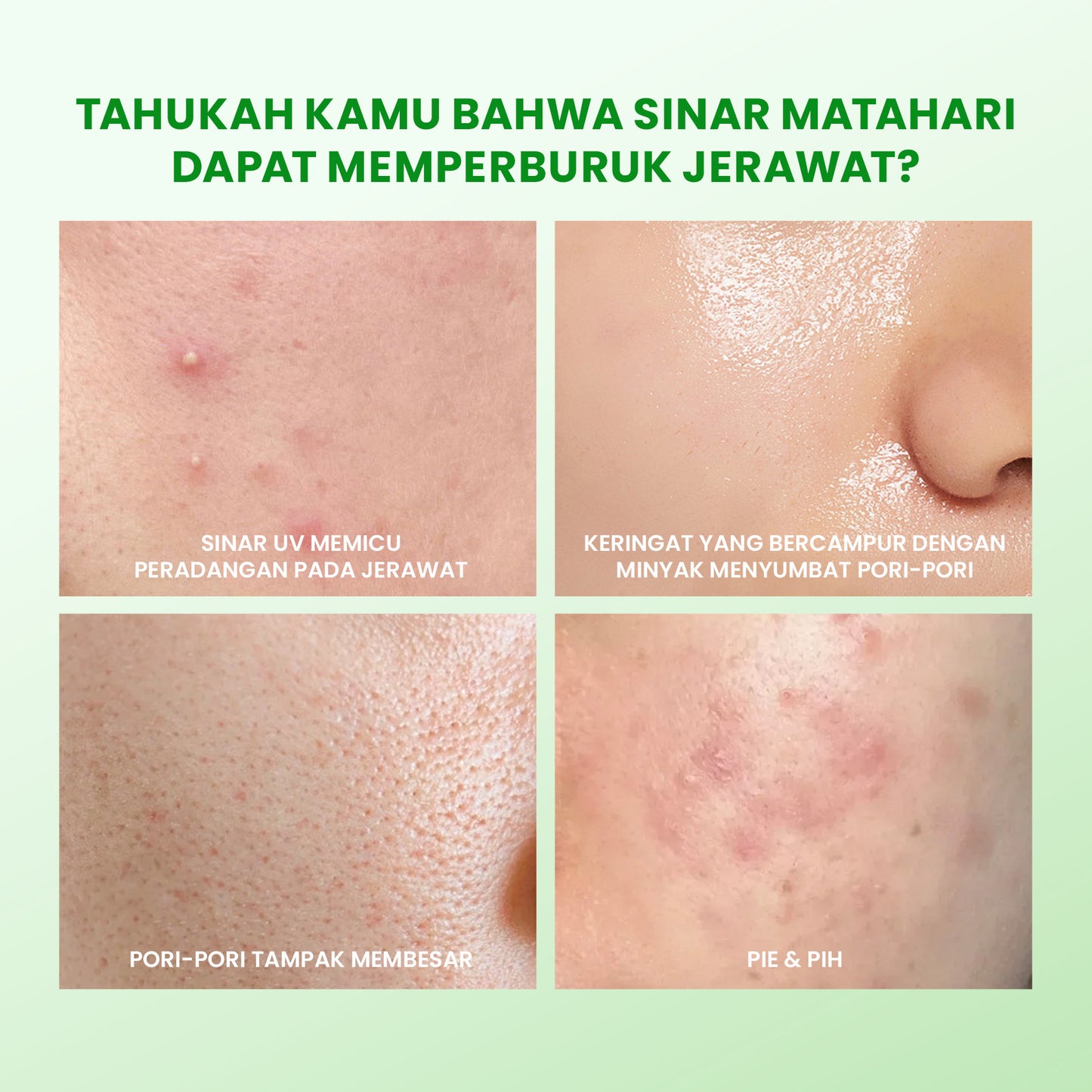 [NEW] YOU Sunbrella Acne Shield Light Sunscreen SPF40+ PA++++ | Tabir Surya Oil Control untuk Kulit Berjerawat | Sensitive Acne Skin Friendly | UVA UVB Blue Light