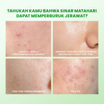 [NEW] YOU Sunbrella Acne Shield Light Sunscreen SPF40+ PA++++ | Tabir Surya Oil Control untuk Kulit Berjerawat | Sensitive Acne Skin Friendly | UVA UVB Blue Light