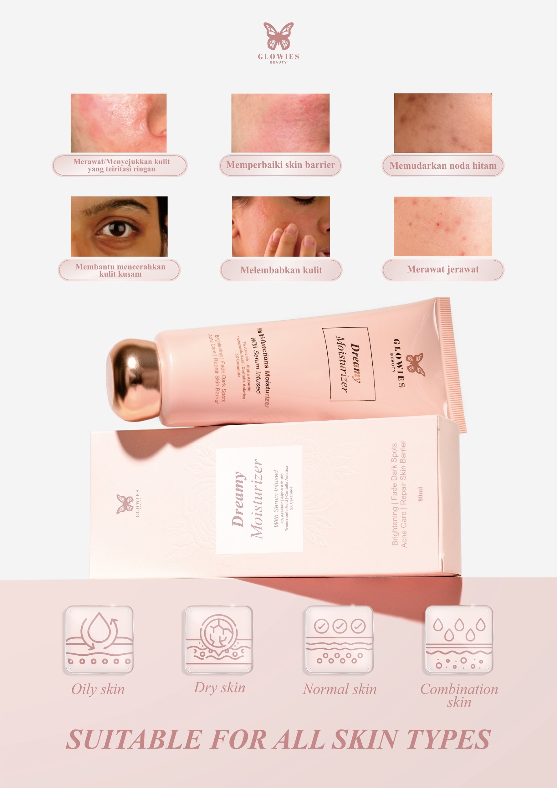 Glowies Beauty Dreamy Moisturizer 80ml Busui Friendly membantu Mencerahkan & Meratakan Warna Kulit Menghilangkan jerawat PIE PIHFormulasi Korea 7% Azeclair 6% Niacinimide Alpha Arbutin 5x Ceramide Pelembab wajah kering dan Sensitif