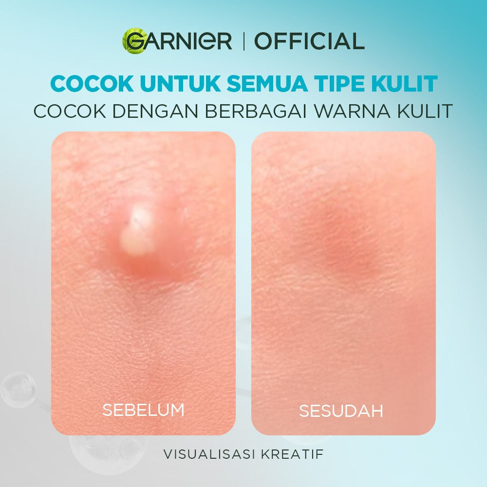 [EKSKLUSIF] Garnier Invisible Acne Patch Jerawat Transparan Isi 22 Pimple Patch Sticker jerawat kempes dalam 8 jam