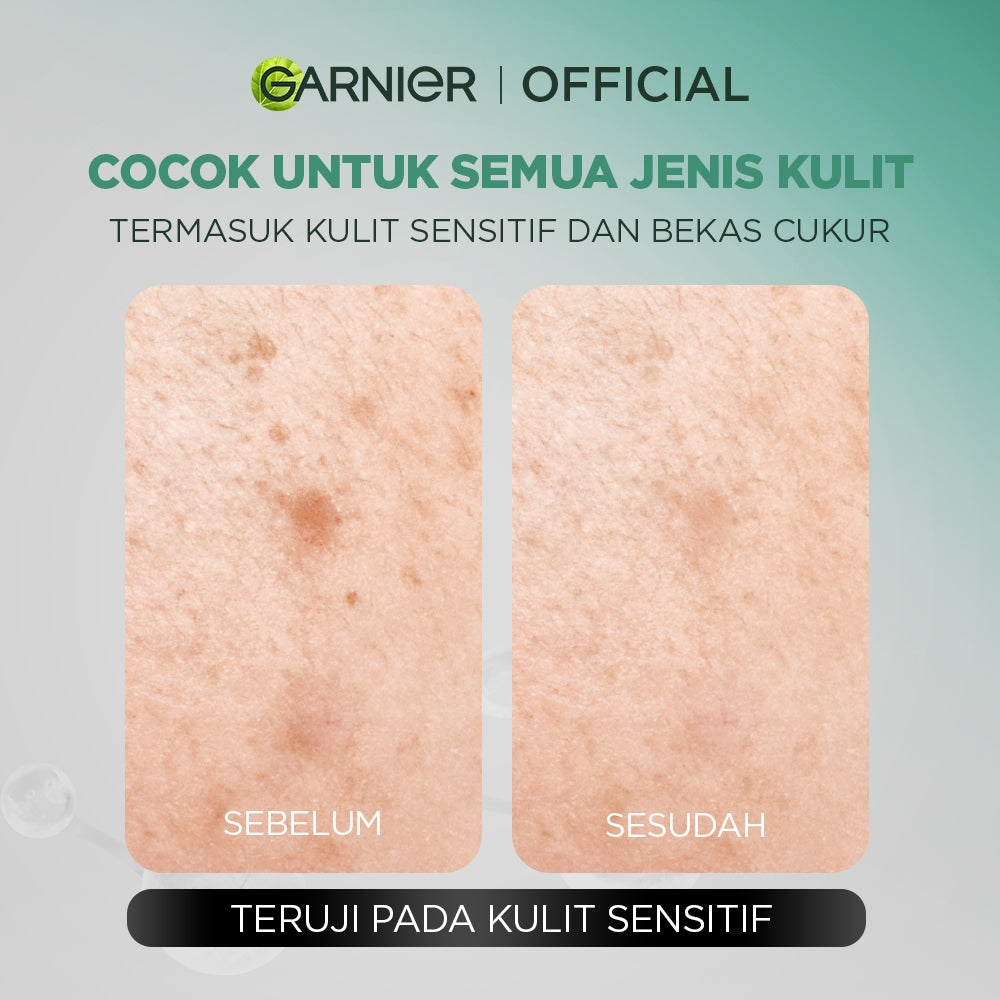 BARU Garnier Men Facial Wash Acno Fight Acne Calming Gentle Low PH Gel Cleanser 100ml Sabun Cuci Muka Pria Moisturizer Sunscreen Face Wash Facial Wash