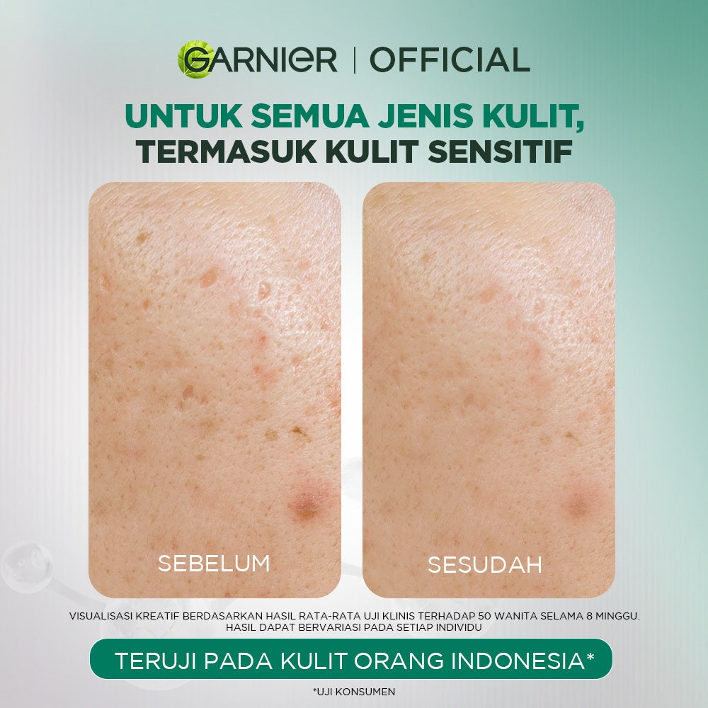 GARNIER Tri Acid Renew Peeling Serum Exfoliasi Wajah - Glass Skin AHA BHA PHA 10% Niacinamide 5% Skincare Exfoliating Renewal Concentrate kulit ideal daily safe for sensitive skin exfoliant serum mencerahkan wajah