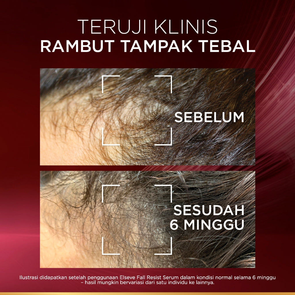 [BARU] L'Oreal Paris Elseve Aminexil Serum  - Anti Hair-Fall Serum With Aminexil - 102ml -  Perawatan Kekuatan Rambut, yang Rambutnya patah , Rambut Rontok, Serum Kulit Kepala.