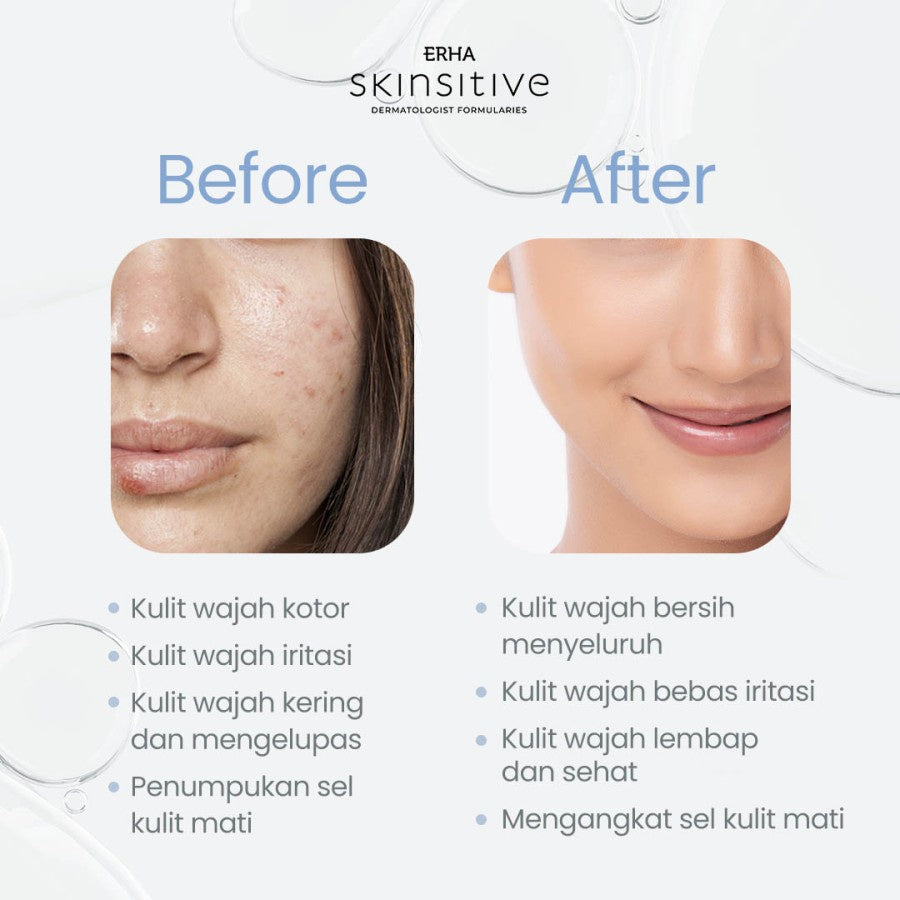 ERHA Twin Flame Skinsitive Facial Wash 80g - Sabun Wajah Sensitif & Aman untuk Semua Jenis Kulit