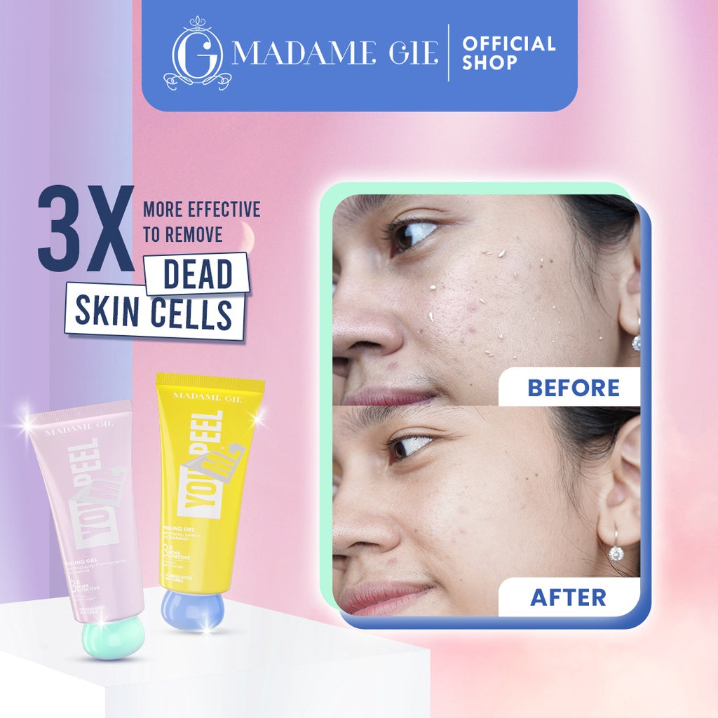 [BELI 2 LEBIH HEMAT]  Madame Gie Madame You Peel Me - Peeling Gel