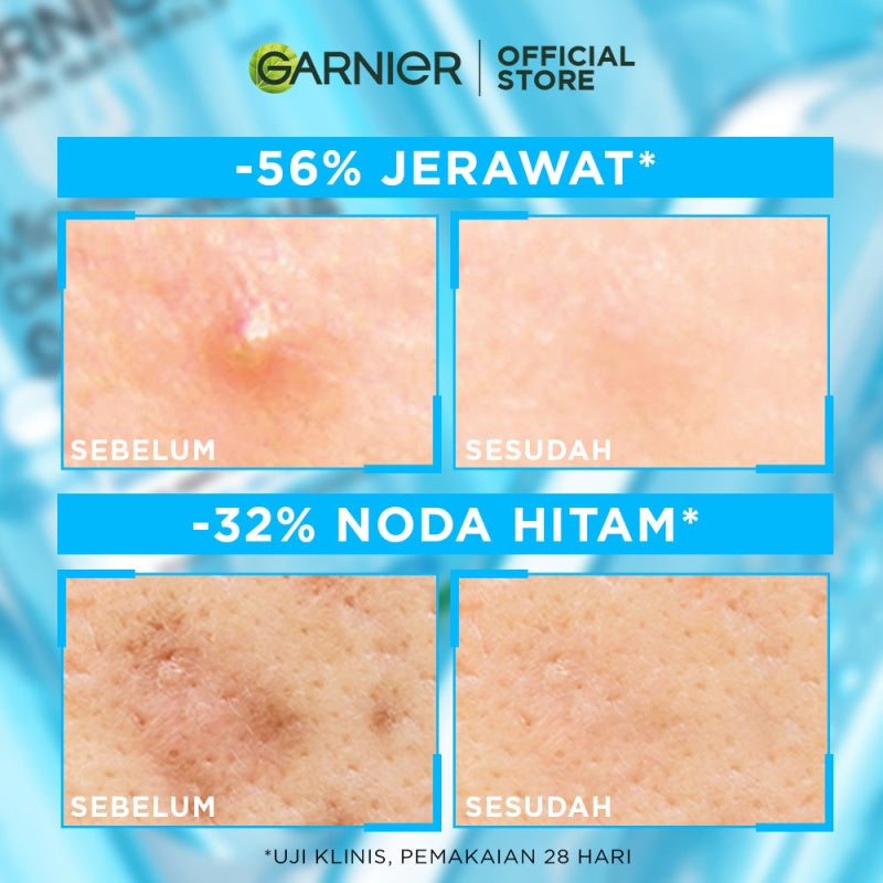 GARNIER Micellar Water Blue Salicylic Acid 125ml Skincare Cleansing - Skincare Pembersih Wajah & Make up untuk kulit berminyak jerawat Micellar Cleansing Water