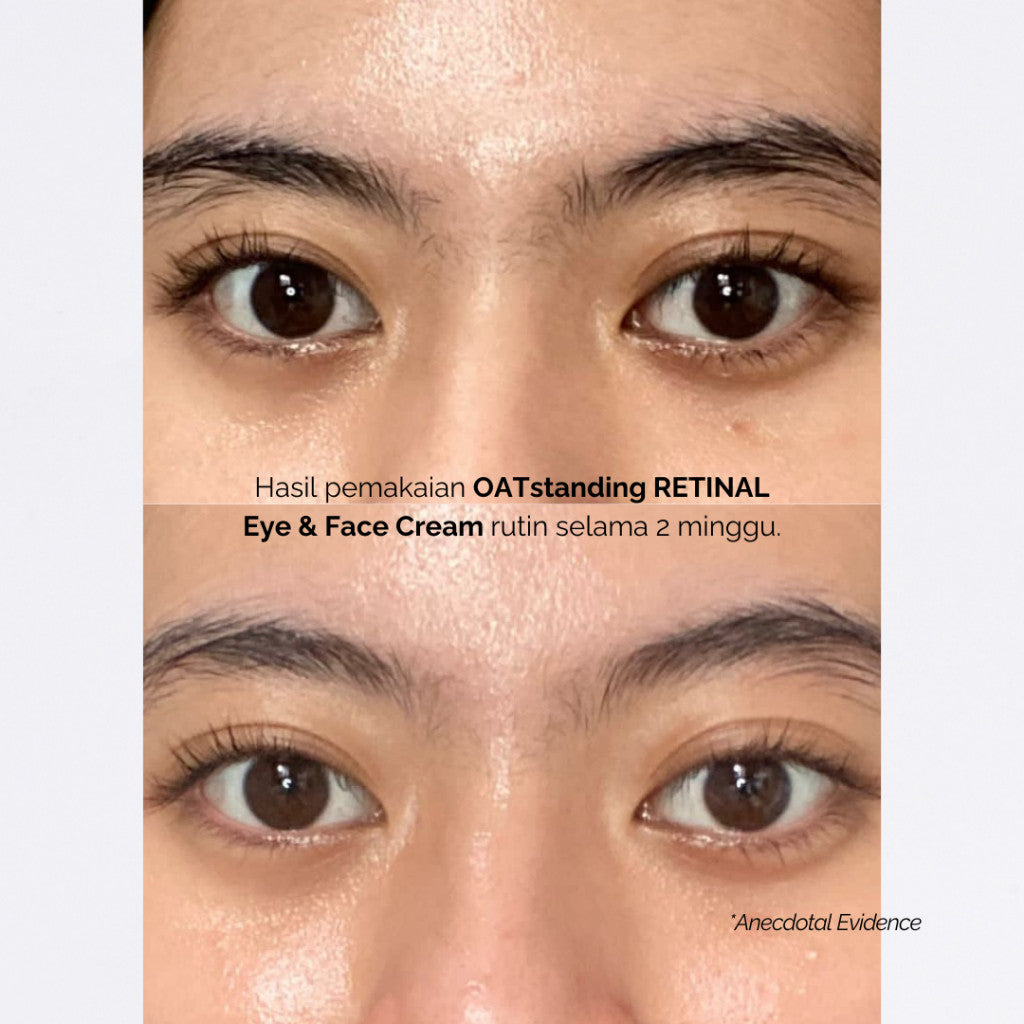 Finally Found You! FFY OATstanding Retinal - 2in1 Eye & Face Cream Krim Mata Panda dan Kerutan 20ml