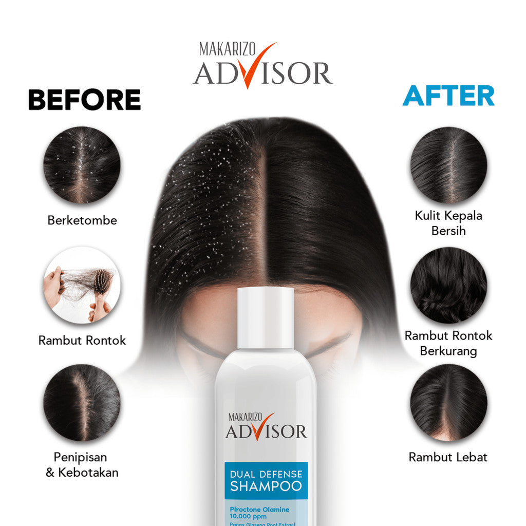 PAKET EXPERT RAMBUT RONTOK & KETOMBE - Makarizo Advisor Dual Defense Shampoo + Hair & Scalp Tonic