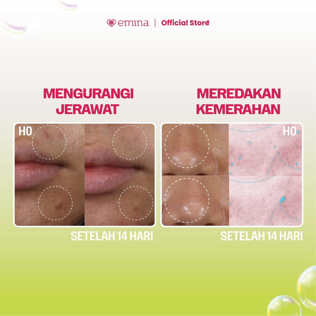 NEW! Emina Prebiotic Tranexamic Acid Brightening Face Wash for Acne Prone Skin 50ml 100ml - Sabun Muka kulit berjerawat dan sensitif, Perbaiki Skin Barrier Mengontrol Minyak Lembab Tanpa Ketarik Cocok untuk semua jenis kulit