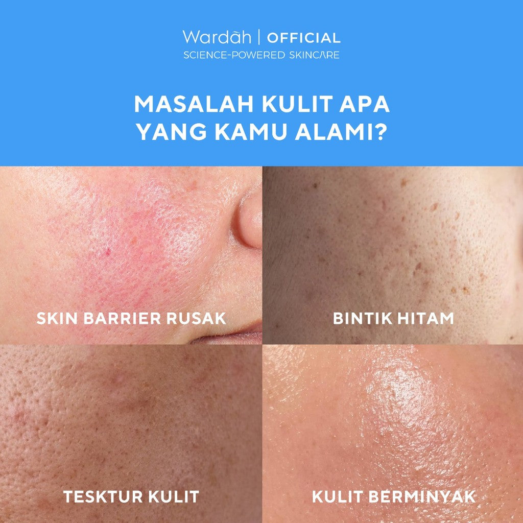 NEW PACKAGING! Wardah UV Shield Airy Smooth Sunscreen Serum SPF 50 PA++++ 25ml Single, Twinpack, Triple Pack Sunscreen Wajah - Meredakan Jerawat, Ringan, Mudah Meresap Calming and Repair Boosting - Sunscreen 50 SPF BPOM - Sunscreen Wajah Glowing