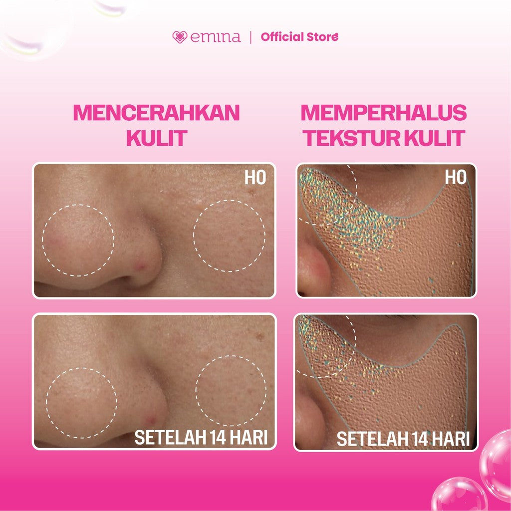 NEW! Emina Niacinamide Oxy Ceramide Brightening Face Wash 50ml 100ml - Sabun Muka Cerah, Glowing, Perbaiki Skin Barrier, Mengontrol Minyak Sebum, Lembab Tanpa Ketarik, Anti Kusam, Cocok untuk semua jenis kulit