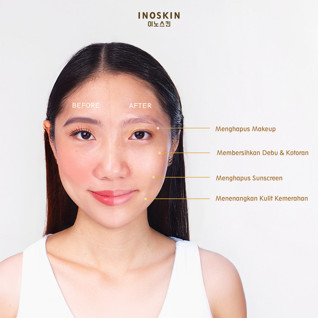 Inoskin Triple Power Cleanser (New Improved Formula )135mL