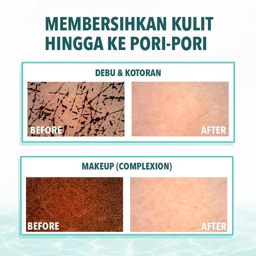 Emina Low pH Micellar Water  untuk Kulit Berminyak dan Berjerawat Sensitif 125ml & 300ml | Salicylic Acid Pembersih Wajah Gentle Makeup Remover Double Cleansing for Acne-Oily Prone Skin Oil Control Moisturizer Sunscreen Mencerahkan