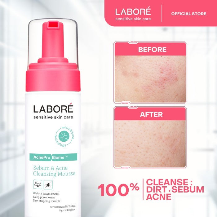Labore Sensitive Skin Care AcnePro Biome Sebum & Acne Cleansing Mousse
