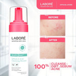 Labore Sensitive Skin Care AcnePro Biome Sebum & Acne Cleansing Mousse