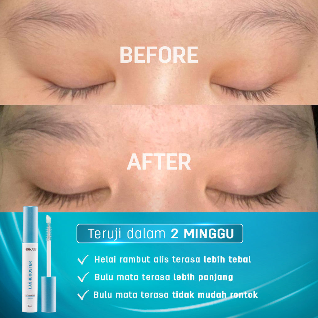 ERHAIR Lashbooster Multi-Peptide Lash & Brow Serum (3ml) - Serum Alis & Bulu Mata Rekomendasi Dermatologis 12% Peptide Complex | Hypoallergenic formula | Mengurangi rontok