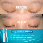 ERHAIR Lashbooster Multi-Peptide Lash & Brow Serum (3ml) - Serum Alis & Bulu Mata Rekomendasi Dermatologis 12% Peptide Complex | Hypoallergenic formula | Mengurangi rontok