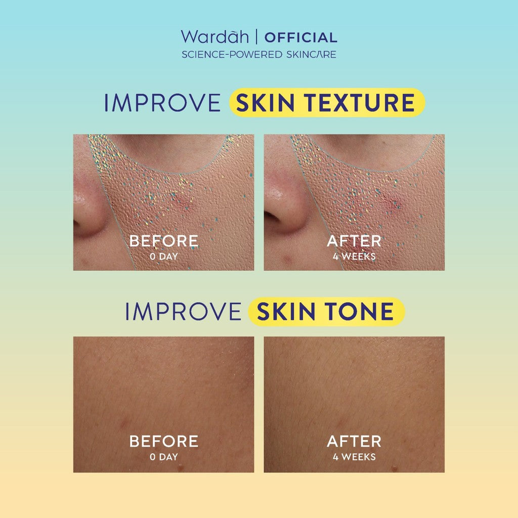 WARDAH Perfect Bright Perfectyl + Vitamin C Pore Perfecting C-Glow Serum - Micro Peeling Serum-Mencerahkan dan Menghaluskan kulit serta Mengecilkan Pori-Pori, Wajah Kusam, Berminyak, Berjerawat - Skincare