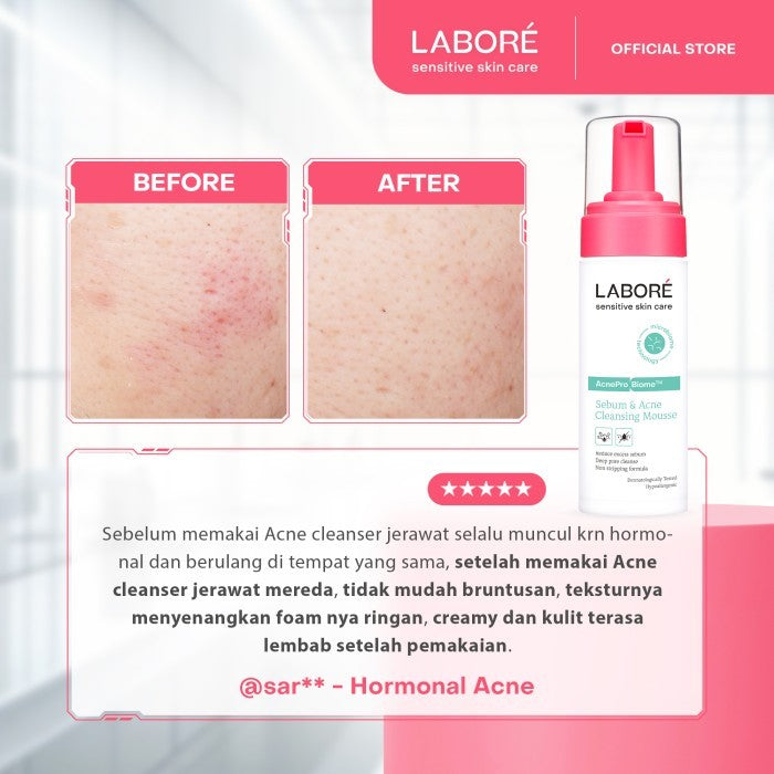 Labore Sensitive Skin Care AcnePro Biome Sebum & Acne Cleansing Mousse