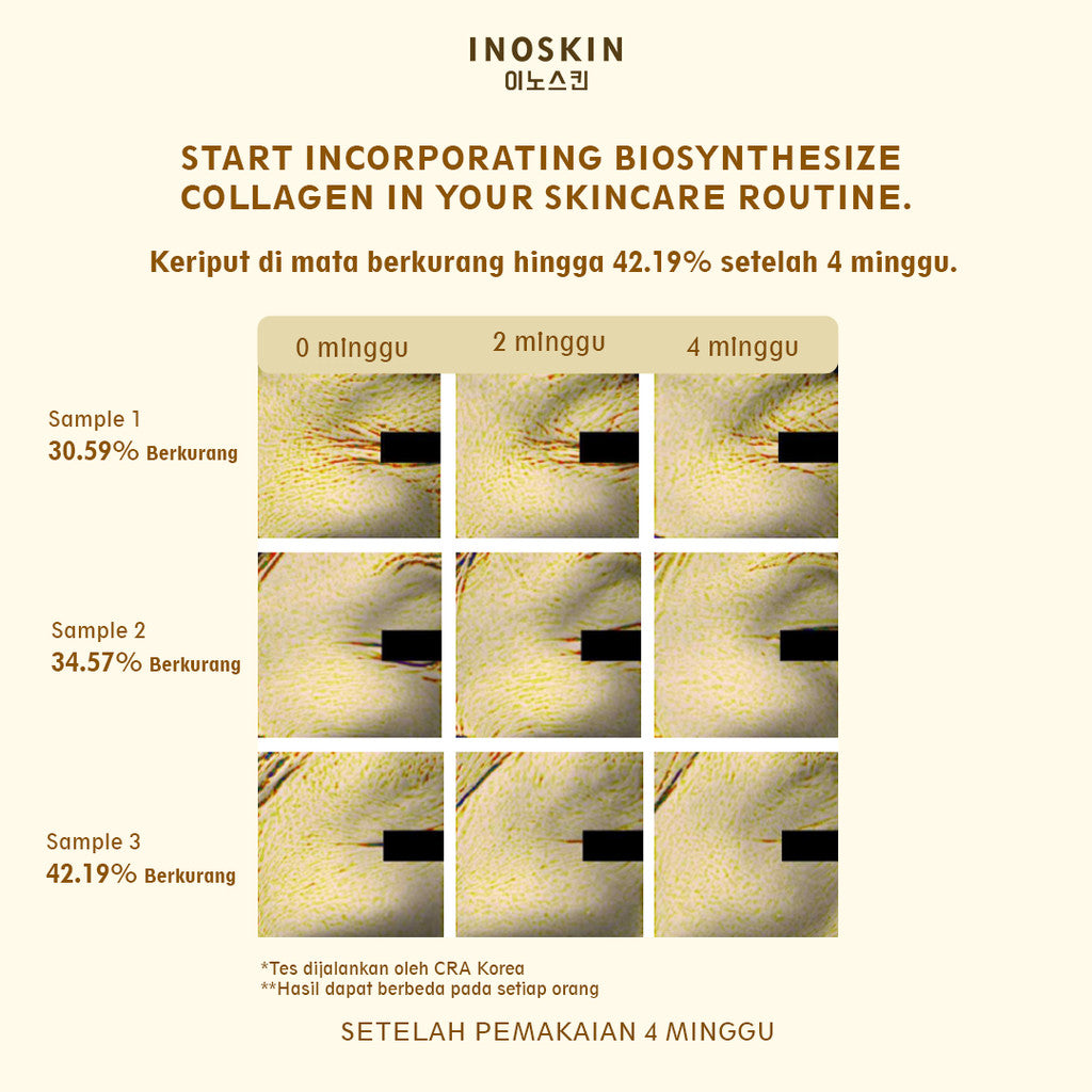 Inoskin Young & Bright Moisturizer 50 mL | Collagen Skincare | Biosynthesize Collagen Moisturizer