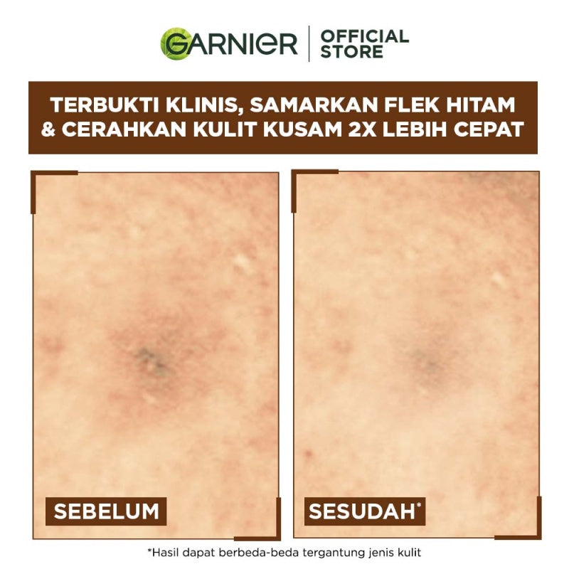 Garnier Vitamin C Day & Night Starter Kit - Foam Cleanser 100ml + Micellar Vitamin C 125ml + Bright Complete Serum 15ml + Overnight Serum 15ml