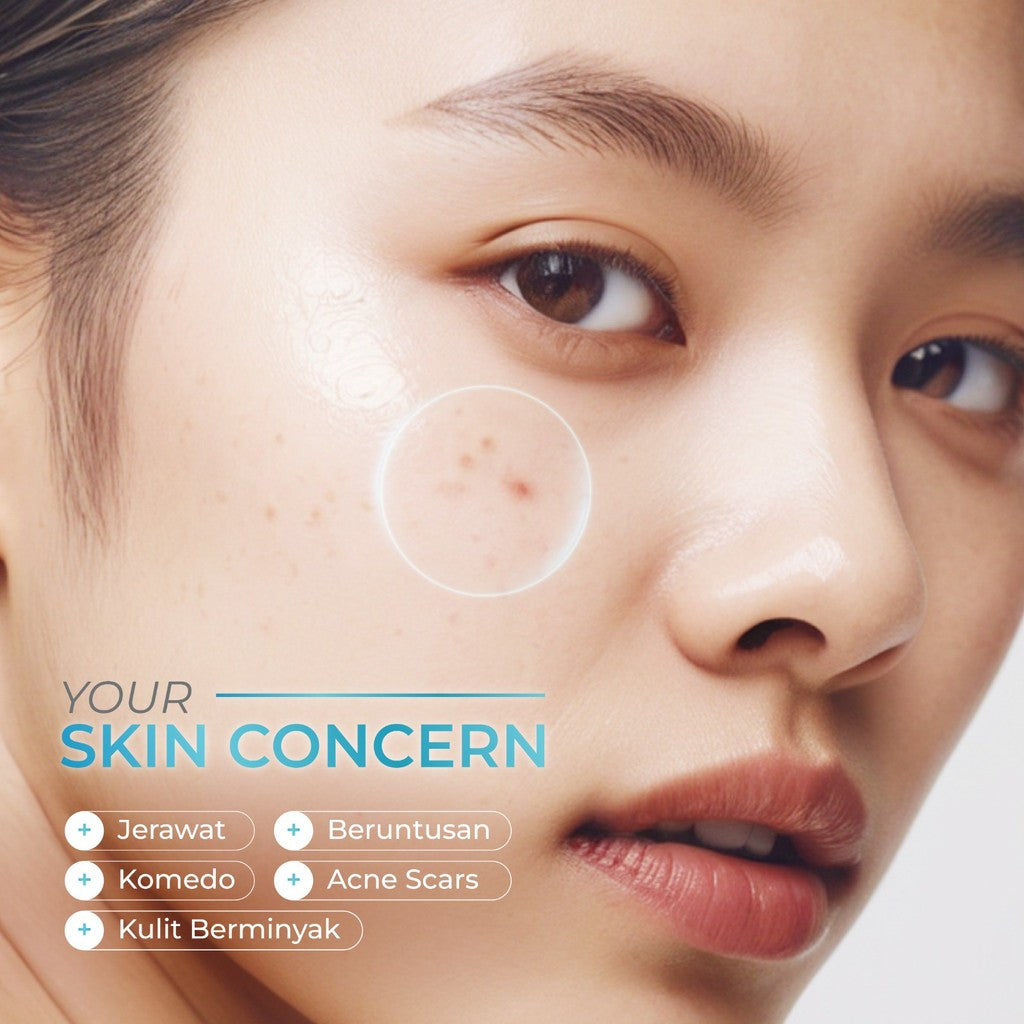 WARDAH Acnederm Salicylic Acid Zinc Acne Clearing Low pH Foaming Cleanser - Skincare