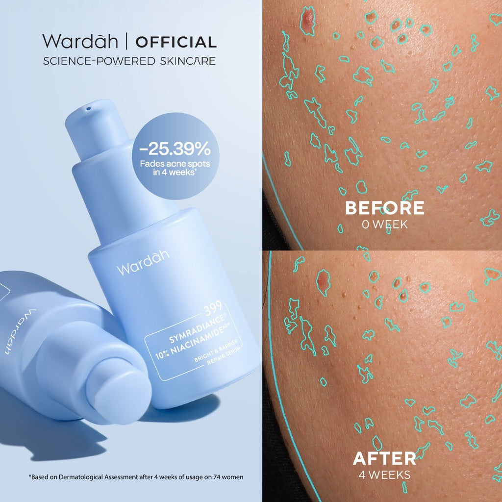 WARDAH Lightening Symradiance 399 + 10% Niacinamide Skin Care All Series Lengkap ADV Bright & Barrier Boost - Serum dan Moisturizer Mencerahkan Kulit Kusam Bekas Jerawat, Mencegah Hiperpigmentasi, Pelembab - Skincare
