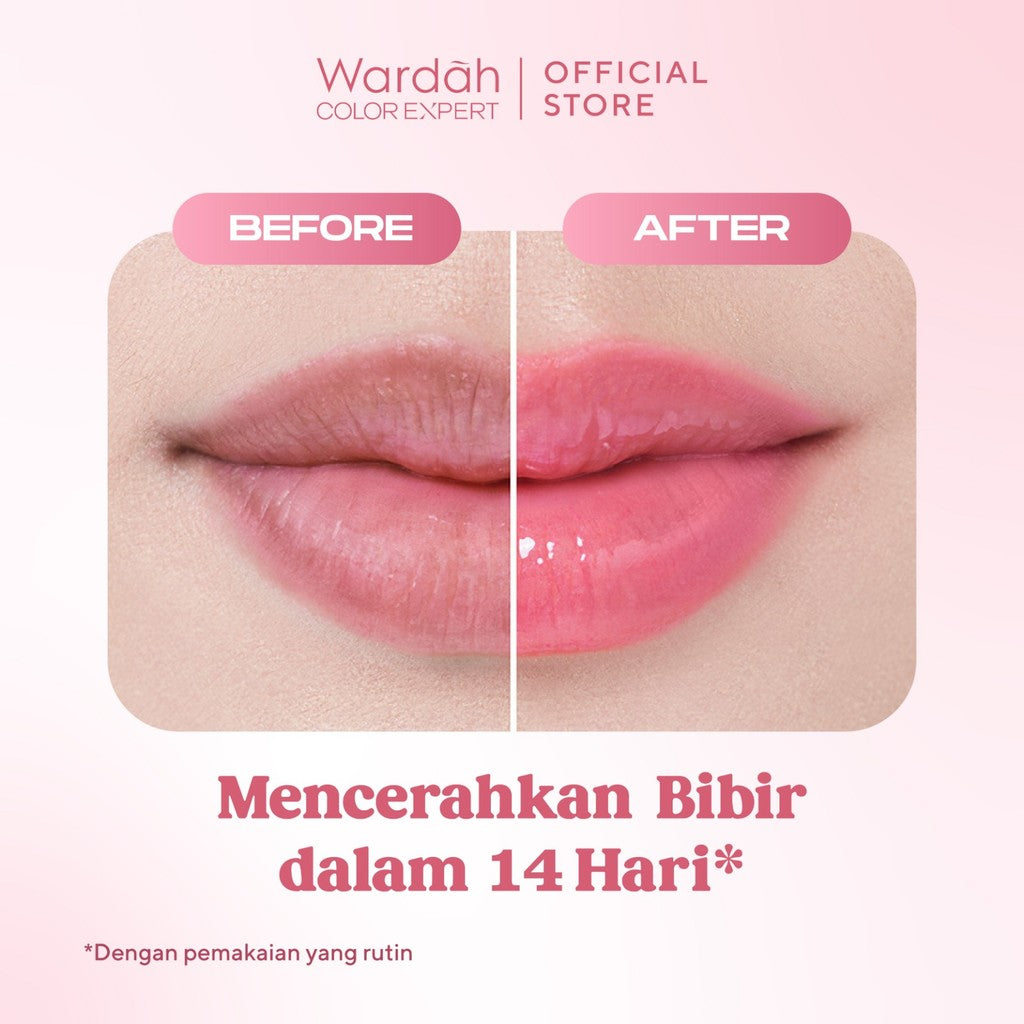 [LIP CARE MENCERAHKAN] NEW! WARDAH Lip Rescue Jelly Balm Dusty Rose - Lip Therapy, Hydrating - Mencerahkan Bibir, Bibir Sehat, Plump - Glossy, Lip Matte, Liptint, Lip Stain, Lipgloss, Lip Cream, Lip tint Waterproof -Tahan Lama - Dark Lips - Bibir Pecah