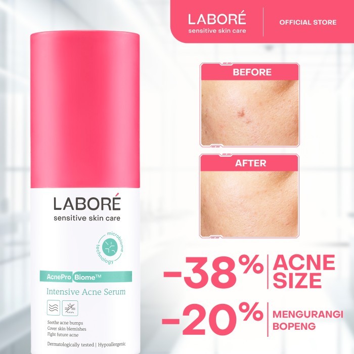 Labore AcnePro Biome Intensive Acne Serum 7ml 20ml - Serum Intensif Kulit untuk Mengatasi Permasalahan Kulit Berjerawat
