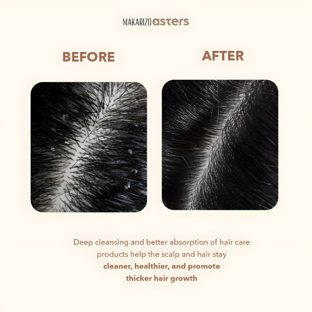 Makarizo Asters Scalp Therapy Massager